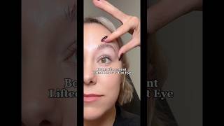 Botox placement for brow lift vs cat eye revivechattanooga botox [upl. by Aivan]