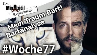 Meine Bartanalyse und mein TraumBart  Das Minoxidil Experiment Woche77 [upl. by Aytnahs]