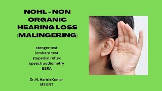 NOHL  NON ORGANIC HEARING LOSS  MBBS  ENT [upl. by Asit431]