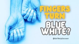 Fingers turn Blue and white in Cold  Protecting Your Fingers and Toes [upl. by Elleira912]