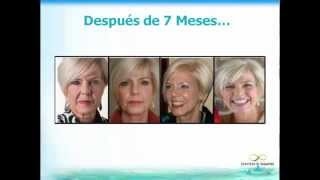 ¿Cómo rejuvenecer hasta 15 años en 90 días sin botox ni cirugía ComoRejuvenecer MásJovenEn15Min [upl. by Conias]