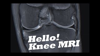 How To Analyze A Knee MRI [upl. by Lesde]