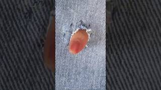 How to fix this hole shortfeed sewingsecrets stitching stitchingideas craft sew diy howto [upl. by Gyatt]