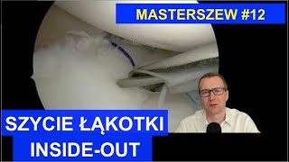 Szycie łąkotki INSIDEOUT  012 [upl. by Richter]