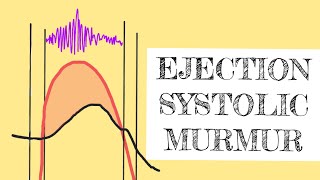 Ejection systolic murmur [upl. by Rhiana835]