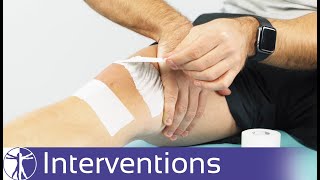 McConnell Taping for PFPS  Patellofemoral Pain Syndrome [upl. by Tufts818]