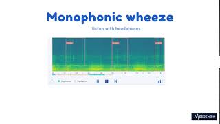 Lung sounds  monophonic wheeze [upl. by Eiten]