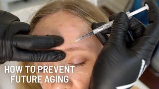 Why You Should Consider Baby Botox in your 20s ft Alicia Castro [upl. by Skvorak]