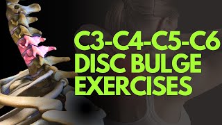 c3c4c5c6 disc bulge exercises in telugu by Nityal Physio [upl. by Alexandre]