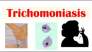 Trichomoniasis Common STI  Causes Symptoms amp Complications Cancer Diagnosis Treatment [upl. by Lanuk]