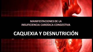 Insuficiencia cardíaca congestiva  Caquexia y desnutrición [upl. by Anad440]