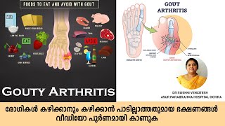 Gouty arthritis നിയന്ത്രിക്കേണ്ട ആഹാരങ്ങൾ  Dr Roshni Ayur Talks  Ayurveda  Malayalam [upl. by Gerick]