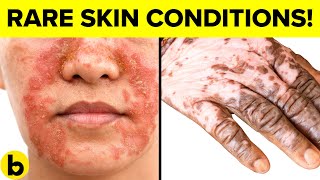 9 DESTRUCTIVE Skin DISEASES And Why You WILL Get Them [upl. by Dorraj]