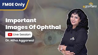 Important Images Of Ophthal  Image based session for FMGE  Dr Niha Aggarwal [upl. by Eserrehs956]