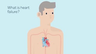 Heart Failure and CRT devices [upl. by Sral]