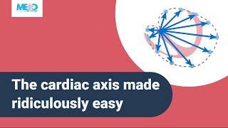 The cardiac axis made ridiculously easy [upl. by Atsillak845]