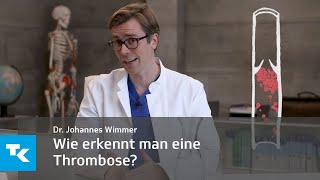 Wie erkennt man eine Thrombose  Dr Johannes Wimmer [upl. by Kirtley]