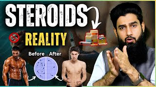 Dark Reality Of Steroids  Steroid Lene se pehle ye video dekhen  Dr Imran Khan [upl. by Crissy]