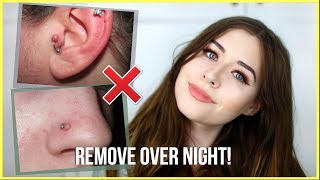 How To Get Rid Of Piercing Bumps OVERNIGHT [upl. by Ellenar]