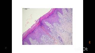 Dermpath2 Dr Rania Elakad [upl. by Zzabahs791]