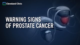 10 Warning Signs of Prostate Cancer [upl. by Leirbag]