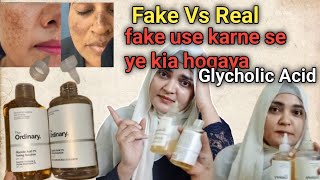 Real Vs Fake The Ordinary Glycholic Acid 7 Toning Solution Review Fake Vs Real [upl. by Lemyt]