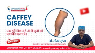 कैफ़ी रोग Caffey Diseases  Dr Gaurav Gupta  Child Orthopedic Surgeon in Delhi [upl. by Stetson]