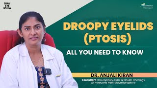 Droopy Eyelids Ptosis Explained  Dr Anjali Kiran  English [upl. by Velvet782]