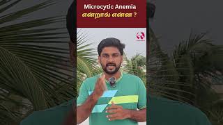 Microcytic Anemia health tamil anemia reason [upl. by Symon]