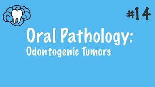 Oral Pathology  Odontogenic Tumors  INBDE ADAT [upl. by Elva]