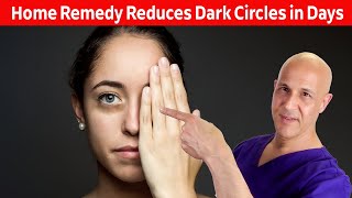 Home Remedy Reduces Dark Eye CirclesResults in Days Dr Mandell [upl. by Alvan328]