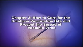 Chapter 3 How to Care for the Smallpox Vaccination Site and Prevent the Spread of Vaccinia Virus [upl. by Ayotnahs]