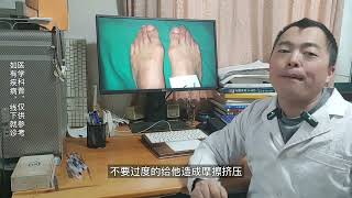 hallux valgus 拇外翻是不是会特别疼痛？如何缓解治疗 [upl. by Calan]