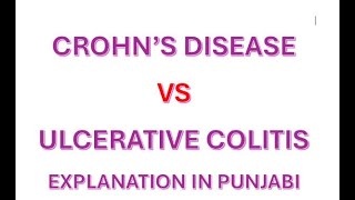 Crohn’s disease vs Ulcerative Colitis punjabi nclex nursing rn nursingofficer nurses india [upl. by Langston]