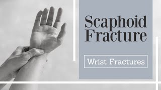 Scaphoid Fractures  carpal bone fracture [upl. by Leihcey996]