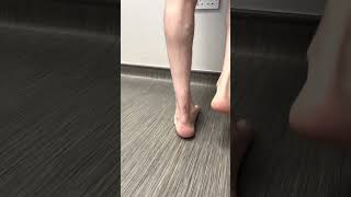 Ruptured Achilles Tendon Recovery 8 Months After Surgery [upl. by Kramal147]