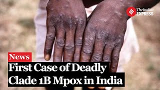 India Reports First Case of Deadly Clade 1B Mpox Raising Global Health Concerns [upl. by Jadd771]