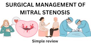 mitral stenosis  Percutaneous Transmitral commissurotomy balloon valvutomy mitral replacement [upl. by Britney]