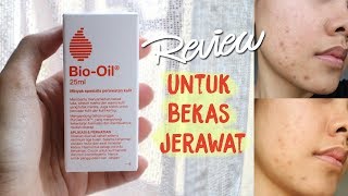 Mini Review BioOil ChitChat ENG SUBS [upl. by Bronk420]