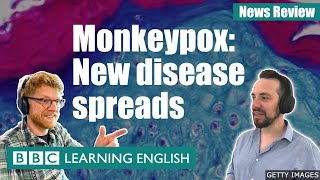 Monkeypox New disease spreads BBC News Review [upl. by Oloap189]