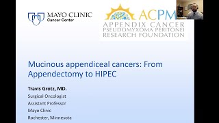 Mucinous Appendiceal Cancers from Appendectomy to HIPEC Dr Grotz Surgical OncologistMayo Clinic [upl. by Akceber]