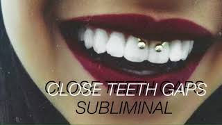 CLOSE TEETH GAPS FAST SUBLIMINAL [upl. by Brookes]