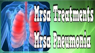 Mrsa Treatments Mrsa Pneumonia Mrsa Pimple Mrsa Infection Control Mrsa In The Blood [upl. by Odericus]