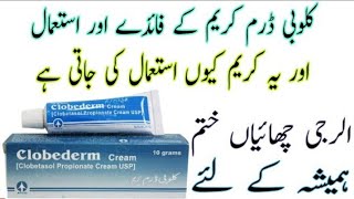 Clobederm cream uses in urdu ClobetasolBenefits I How to apply  Side effectscream [upl. by Bega589]