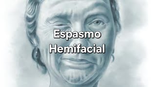 Espasmo Hemifacial [upl. by Eyllom180]