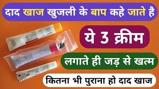 दाद खाज खुजली के बाप है 3 दिन में जड़ से खत्म करे  3 Best Fungal Cream For Dad Khaj Khujli Problem [upl. by Nelie279]