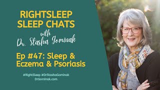 RightSleep Sleep Chat with Dr Stasha Gominak 47 Sleep and Eczema amp Psoriasis [upl. by Kalina297]