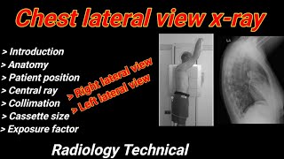 Chest Lateral view Xray  Right amp Left lateral projection  Chest radiography  By BL Kumawat [upl. by Judah18]