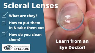 Scleral Lenses What They Are amp How to Use Them [upl. by Weinstock]