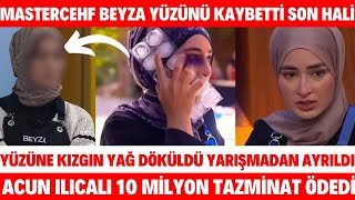 Masterchef Beyzanın Yüzüne Kızgın Yağ Döküldü Son Hali Acun Ilıcalı Tazminat BEYZA YARIŞMADAN ELENDİ [upl. by Iolanthe625]